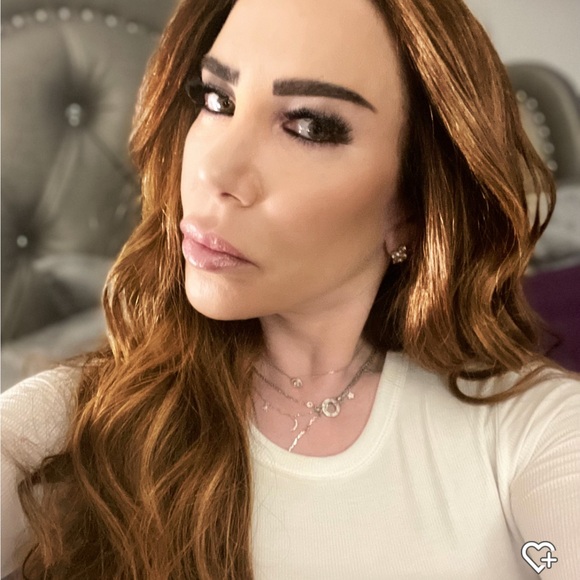 amynytx4103